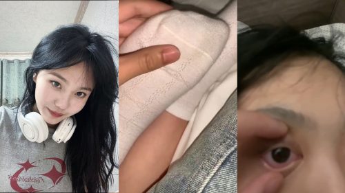 Anesthesia feeds girlfriend, rolls her eyes plays her feet
