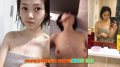 anaesthesia rape